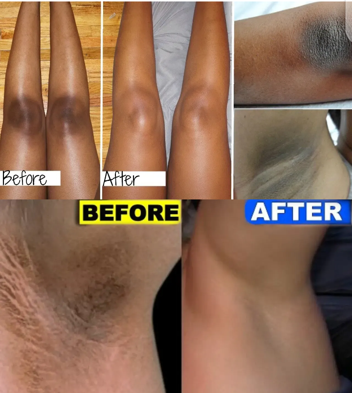 Skin Dark Area Whitening Cream - Image 4