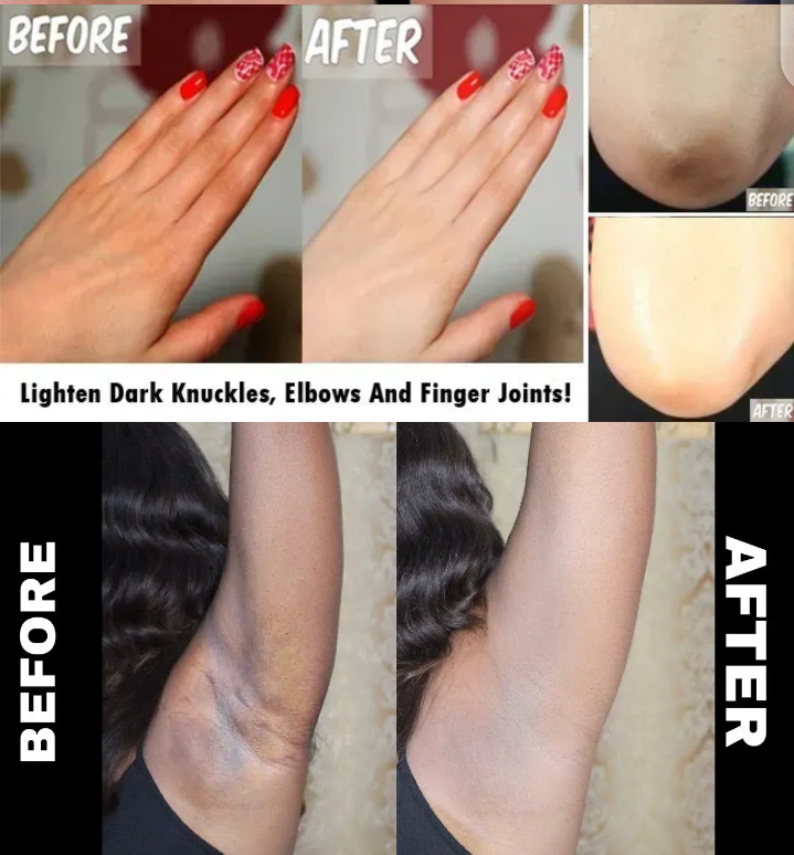 Skin Dark Area Whitening Cream - Image 5